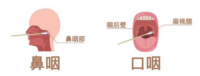 「现在去北京需要核酸检测吗」〃现在去北京需要什么手续
