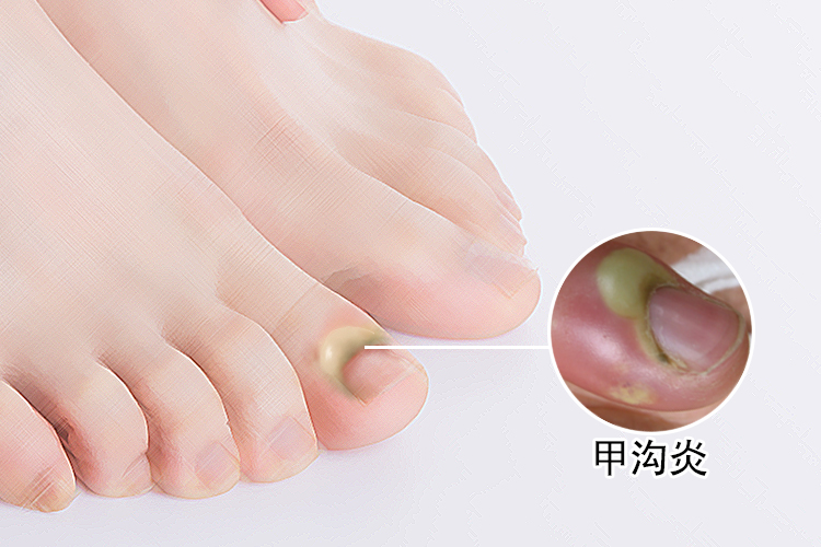 “大连疫情处于胶着期未扩散到市外” 乙肝患者可以吃茄子吗？